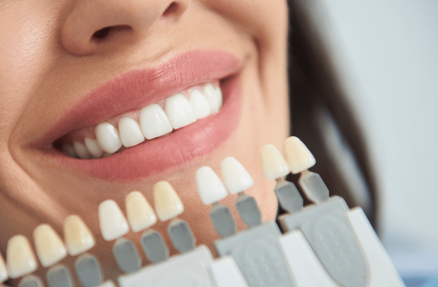 DentalVeneers Beautifi Procedure